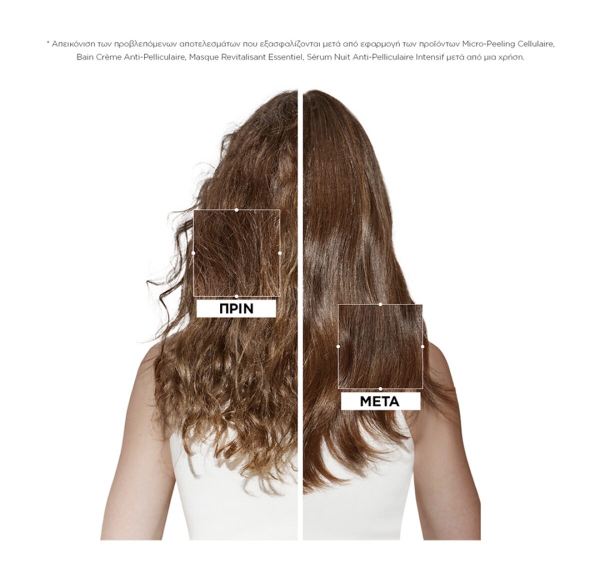 Kérastase Symbiose Fondant Apaisant Essentie Conditioner Για Τριχωτό Με Τάση Πιτυρίδας 200ml - Image 5